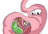 Supplements You Could Take if You Have a Leaky Gut